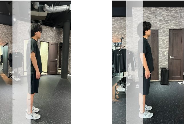 3ヶ月で姿勢改善した男性の画像