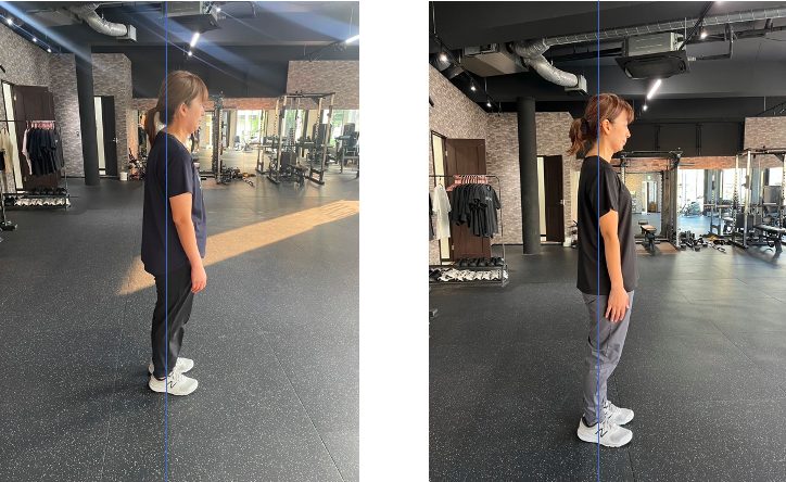 3ヶ月で姿勢改善した女性の画像